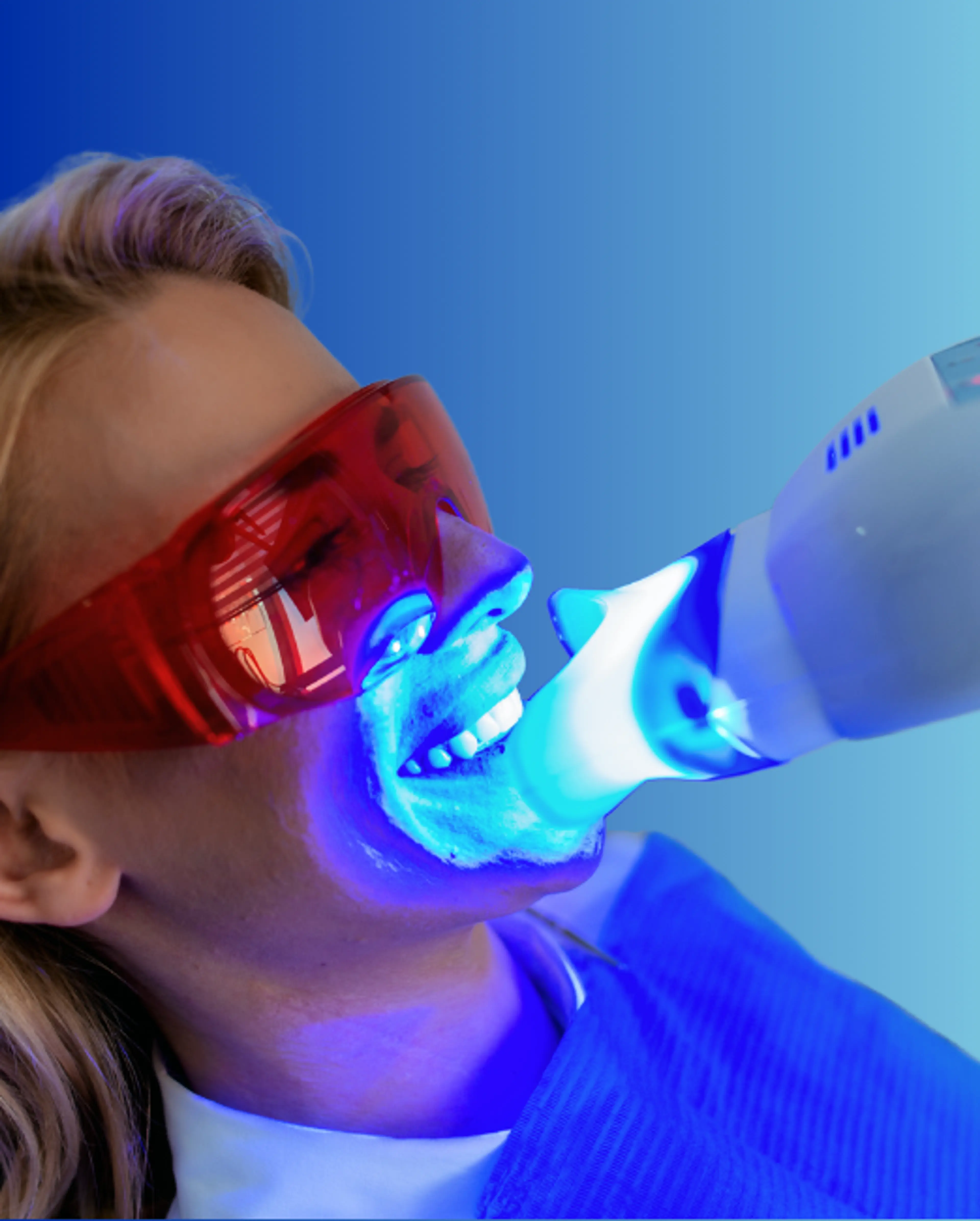 Blanchiment dentaire au laser