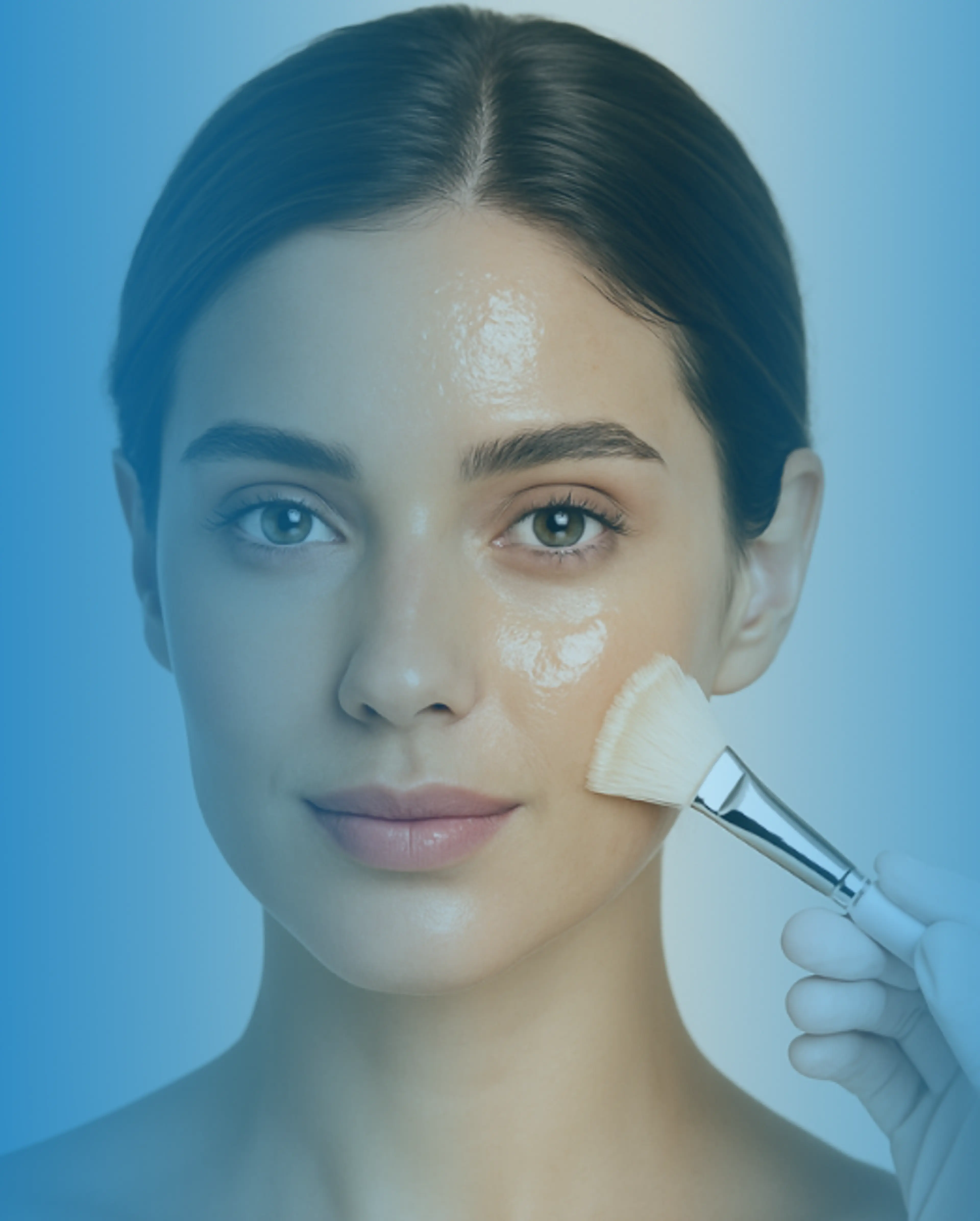 Peeling chimico
